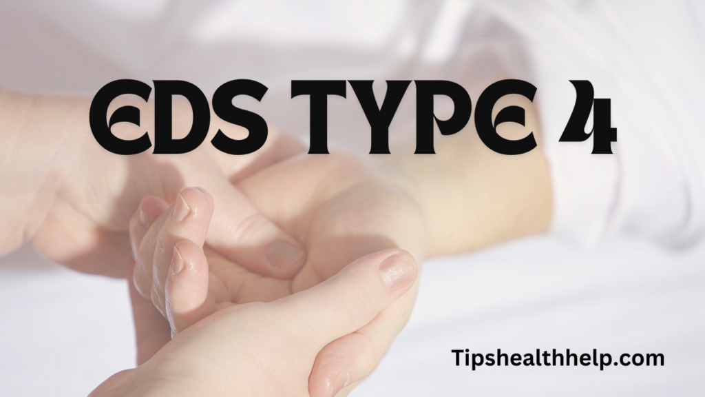 Exploring the Genetics of EDS Type 4: What You Need to Know